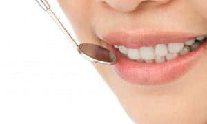primer-plano-de-mujer-en-un-chequeo-dental_1232-217